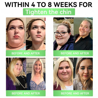 🔥Alcuras™ Moringa × Berberina × AMPK Parche de nano microagujas adelgazante y metabólico de 8 beneficios 🇺🇸 Solo una vez al día · Cambios visibles en 7 días ✅ Para obesidad, piel flácida, diabetes, apnea del sueño, problemas articulares y más