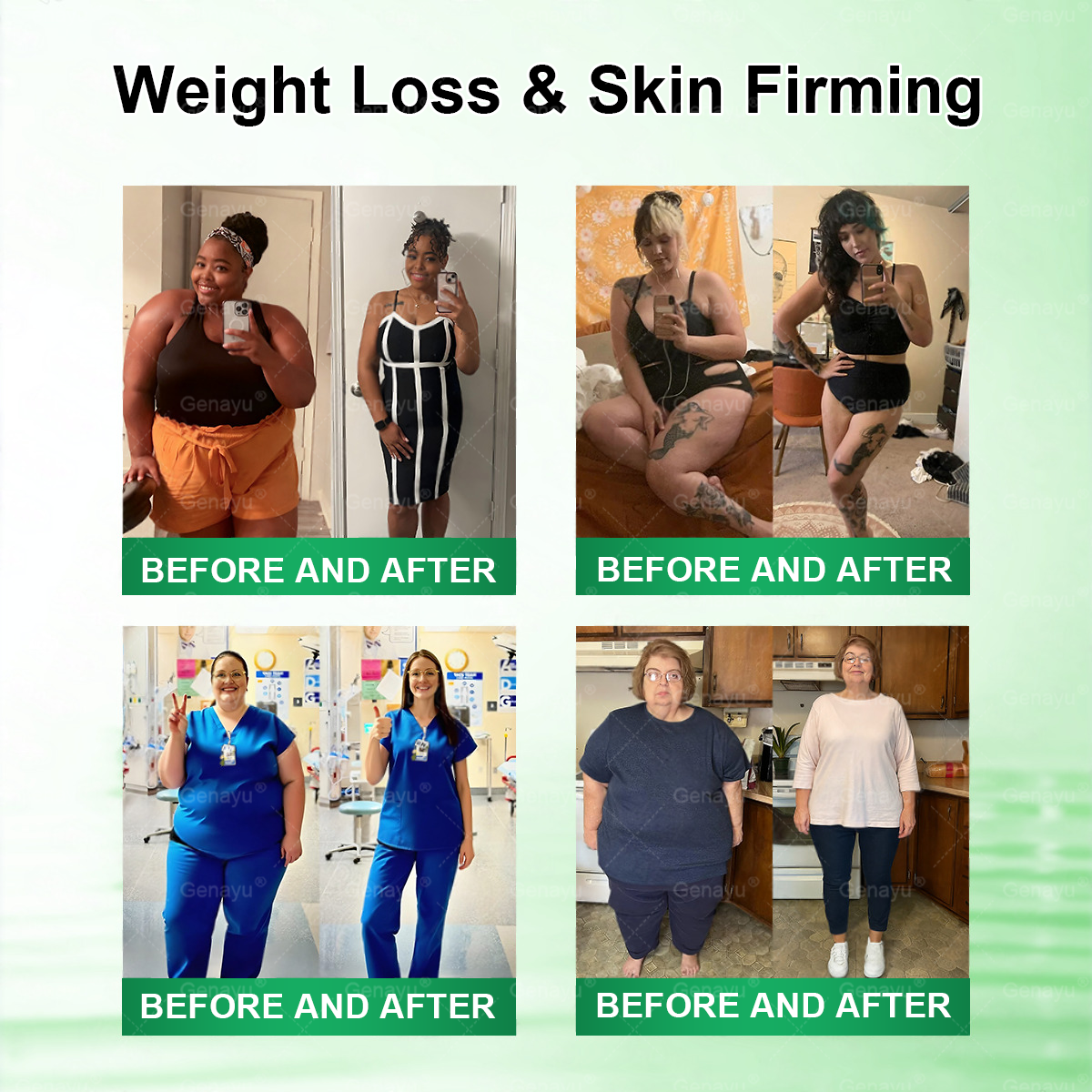 🔥Alcuras™ Moringa × Berberina × AMPK Parche de nano microagujas adelgazante y metabólico de 8 beneficios 🇺🇸 Solo una vez al día · Cambios visibles en 7 días ✅ Para obesidad, piel flácida, diabetes, apnea del sueño, problemas articulares y más