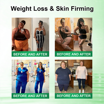 🔥Alcuras™ Moringa × Berberina × AMPK Parche de nano microagujas adelgazante y metabólico de 8 beneficios 🇺🇸 Solo una vez al día · Cambios visibles en 7 días ✅ Para obesidad, piel flácida, diabetes, apnea del sueño, problemas articulares y más
