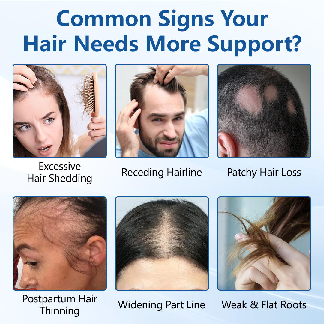 Alcuras® Hair Growth Serum Roll-On