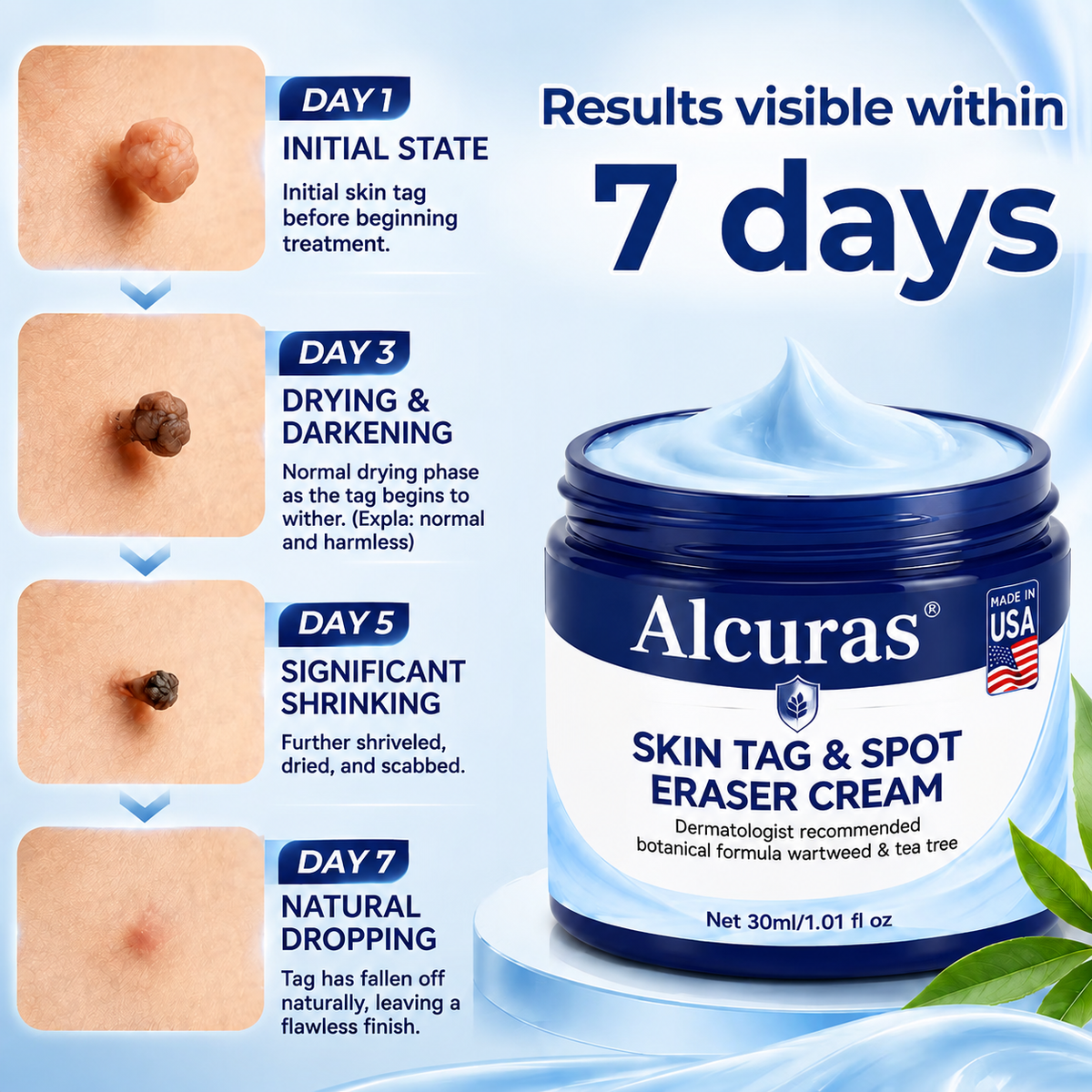 Alcuras® 7-Day Skin Tag & Spot Eraser Cream
