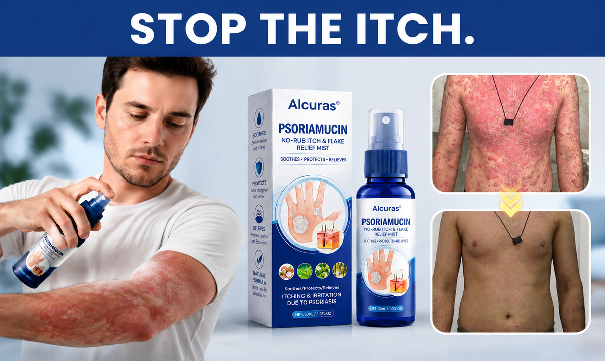 Alcuras®  PsoriaMucin No-Rub Itch & Flake Relief Mist
